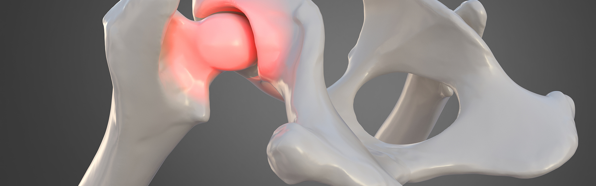 First Signs of Hip Dysplasia and What You Need to Do